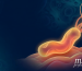 Unveiling H. pylori: Its Name, Origins and Disease Connections