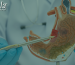 Rethinking Gastric Cancer Prevention