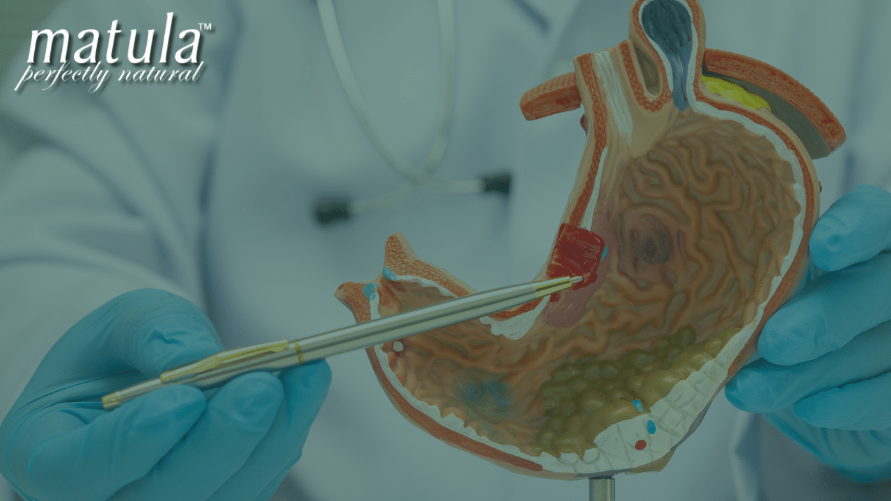 Rethinking Gastric Cancer Prevention
